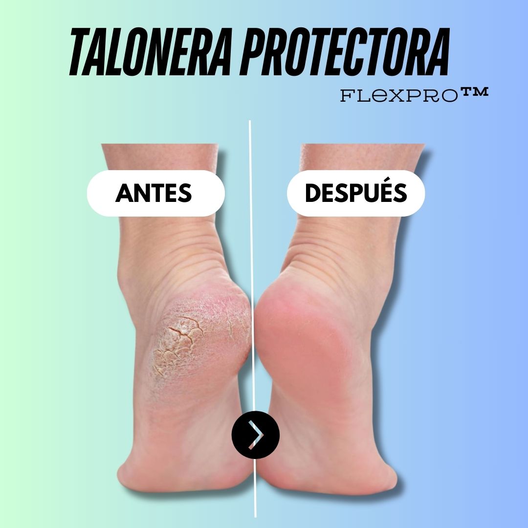 ¡Despídete del dolor! - FlexPro™